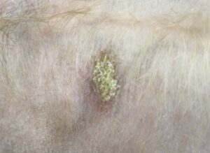 【犬の膿皮症｜かさぶた・フケが出る】悪化しやすい皮膚感染症！シャンプーの効果的なやり方について獣医師が解説！